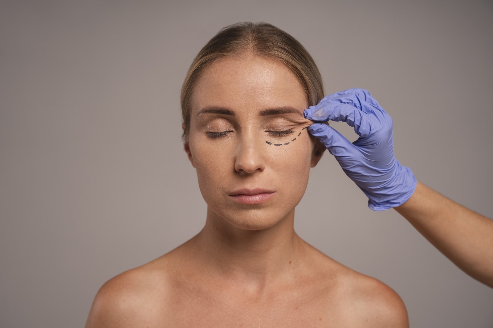 La chirurgie des paupières corrige l’excès de peau et les poches sous les yeux. Elle ouvre le regard tout en conservant l’expression naturelle. Réalisée sous anesthésie locale ou légère, cette intervention offre une récupération rapide. Les incisions sont dissimulées dans les plis naturels. Le résultat : un regard reposé, lumineux et rajeuni.